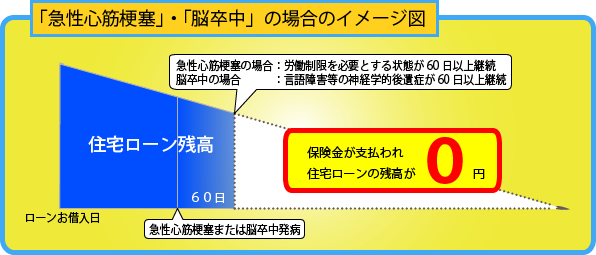 急性心筋梗塞・脳卒中の場合イメージ図